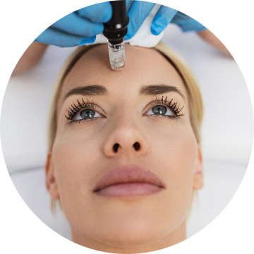 Microneedling Raffine